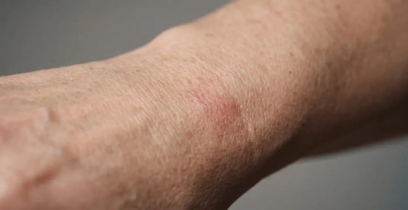 Gros plan sur une peau mature montrant une légère réaction cutanée au contact d'un bijou, représentant les allergies dermatologiques liées aux alliages métalliques après 40 ans